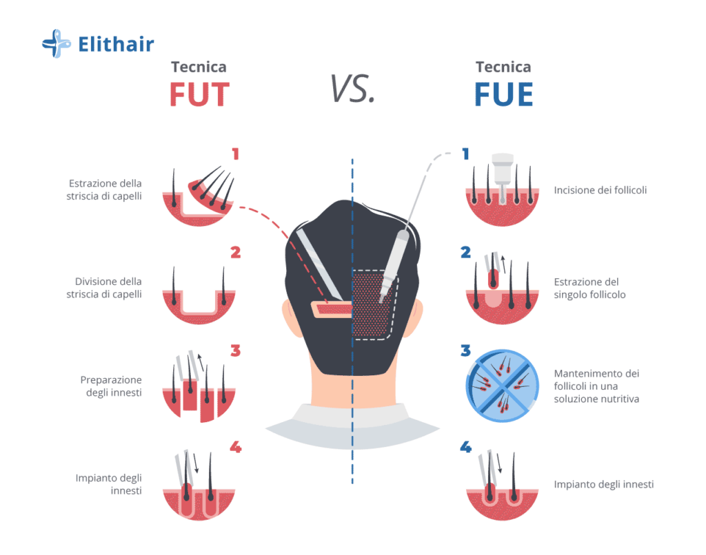 Infografica che mostra il confronto tra le tecniche fut e fue