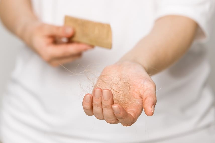 perdita di capelli a causa di alopecia areata