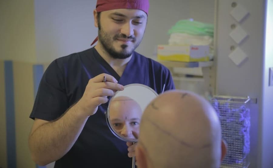 Il Dr. Balwi insieme a un paziente di Elithair che deve sottoporsi a un trapianto di capelli su chierica