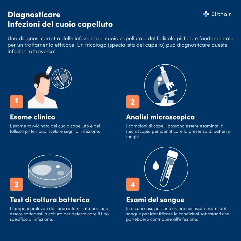 I passi per la diagnosi dell'infiammazione del cuoio capelluto